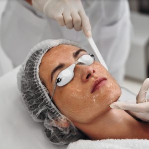 Best Treatment for Peeling Skin in Bandra