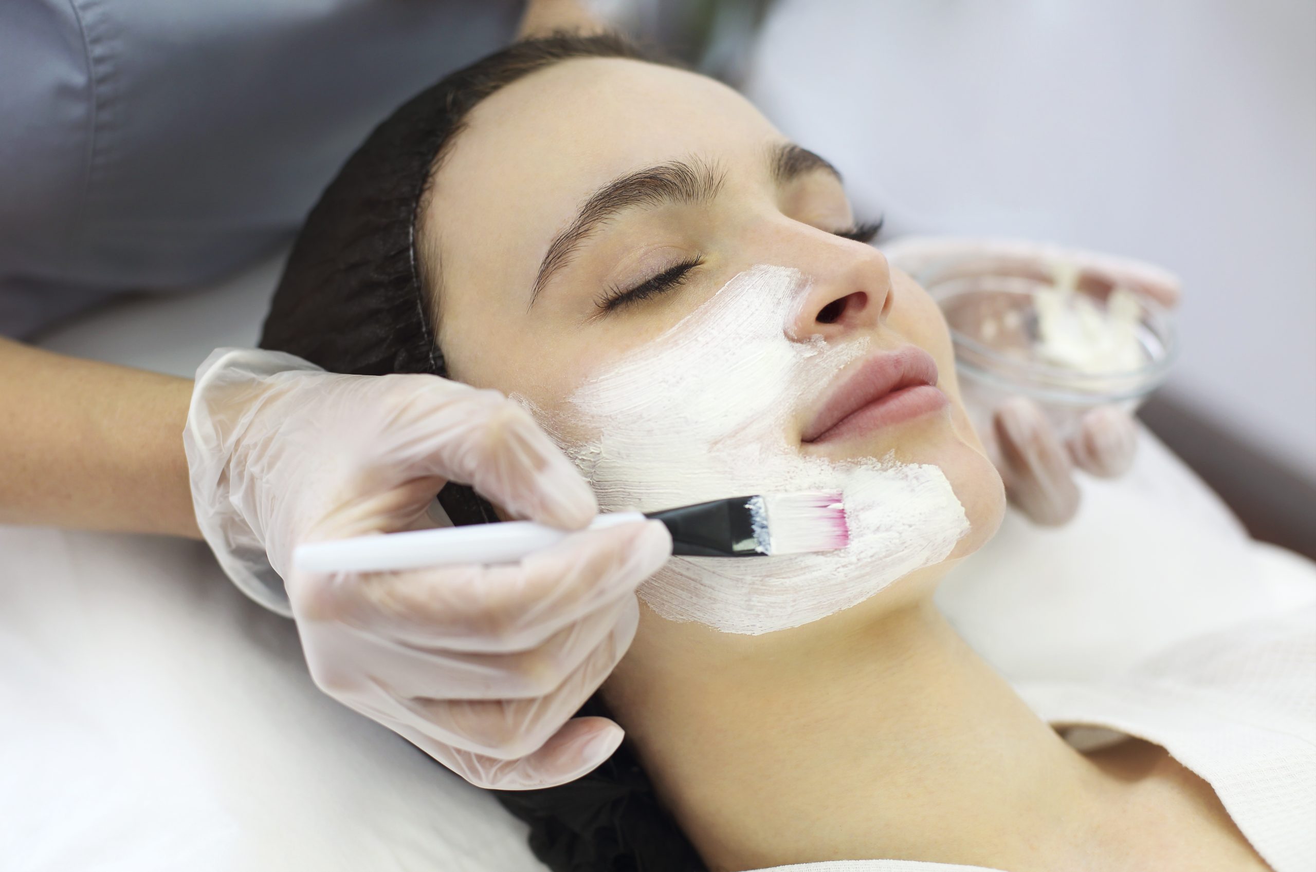 Best Treatment for Peeling Skin in Bandra