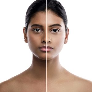 Skin Whitening Treatment in Bandra Skin Whitening Treatment in Bandra
